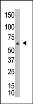 NEK8 Antibody (C-term)