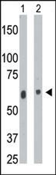 CERK Antibody (C-term)