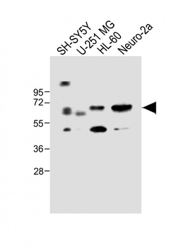 CERK Antibody (C-term)