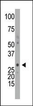 DCK Antibody (C-term)
