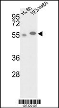 GALK2 Antibody (N-term)