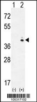 GALK1 Antibody (C-term)