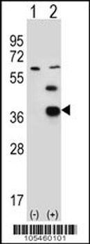 PDXK Antibody (N-term)