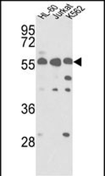 PICK1 (PRKCABP) Antibody (C-term)