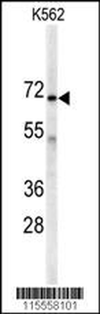 AK7 Antibody (C-term)