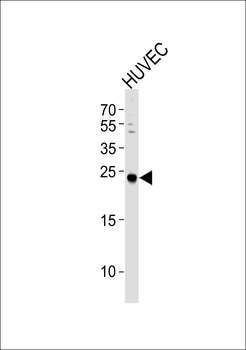 CSNK2B Antibody (C-term F168)