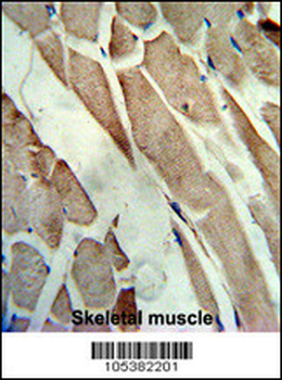 CKM Antibody (C-term)