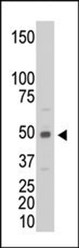 CKM Antibody (C-term)