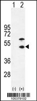 CKM Antibody (N-term)