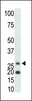 Ketohexokinase (KHK) Antibody (C-term)