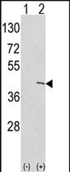 Ethanolamine Kinase (EKI1) Antibody (N-term)
