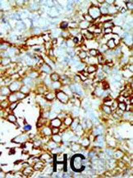 Germinal Center Kinase (GCK/MAP4K2) Antibody (Center)