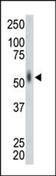 MNK2 (MKNK2) Antibody (N-term)