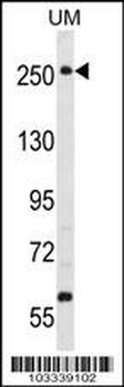 WNK3 (PRKWNK3) Antibody (C-term)