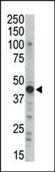 PKA 2 beta (PRKAR2B) Antibody (N-term)