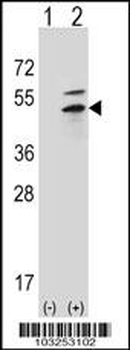 PKA 2 beta (PRKAR2B) Antibody (N-term)