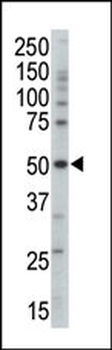 PRKAG3 Antibody (Center)