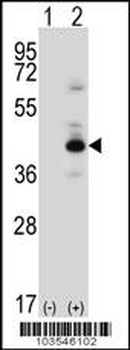PKA C-beta (PRKACB) Antibody (N-term)