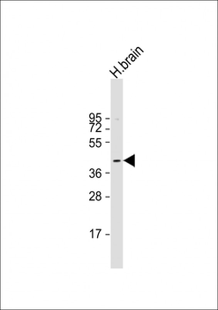 PKA C-beta (PRKACB) Antibody (N-term)