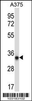 AMPK beta2 (PRKAB2) Antibody (N-term)