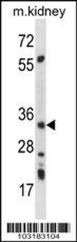 AMPK beta2 (PRKAB2) Antibody (N-term)