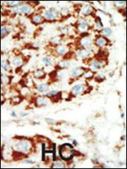 AMPK beta (PRKAB1) Antibody (N-term)
