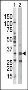 AMPK beta (PRKAB1) Antibody (N-term)
