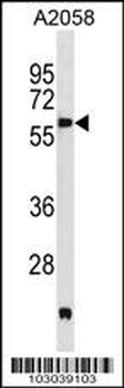 PDK3 Antibody (N-term)