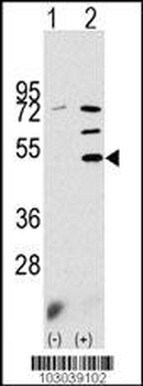 PDK3 Antibody (N-term)