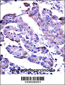 AKT2 Antibody (Center)