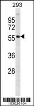 AKT2 Antibody (Center)
