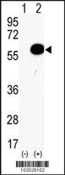 AKT2 Antibody (Center)