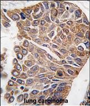 AKT2 Antibody (C-term)