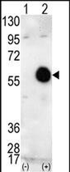 AKT2 Antibody (C-term)