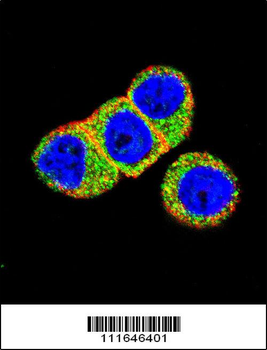 AKT2 Antibody (N-term)