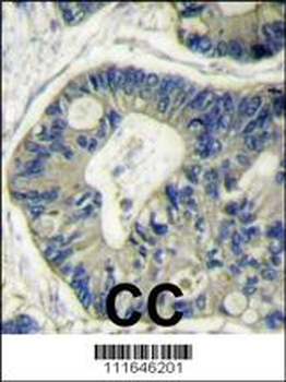 AKT2 Antibody (N-term)