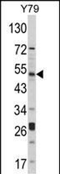 AKT1 Antibody (C-term)