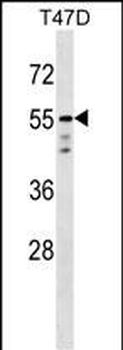 AKT1 Antibody (C-term)
