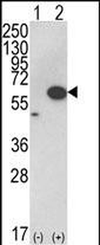 AKT1 Antibody (C-term)