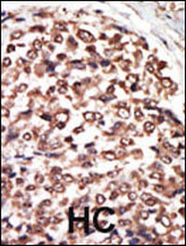 PKC nu Antibody (C-term)