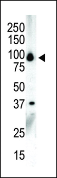 PKC nu Antibody (C-term)