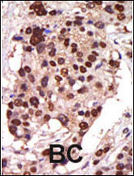 PKC nu Antibody