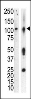 PKC nu Antibody