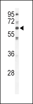 PKC iota Antibody (N-term)