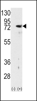 PKC delta Antibody (N-term)