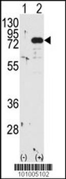 PKC beta1/2 Antibody (Center)