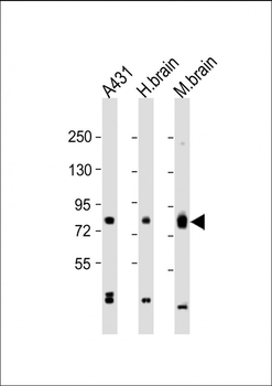 PKC beta1/2 Antibody (Center)