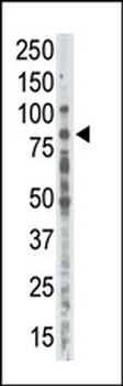 PKC alpha Antibody (C-term)