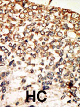 PKA C-alpha/PKA C-beta Antibody (N-term)