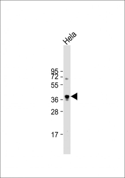 PKA C-alpha/PKA C-beta Antibody (N-term)